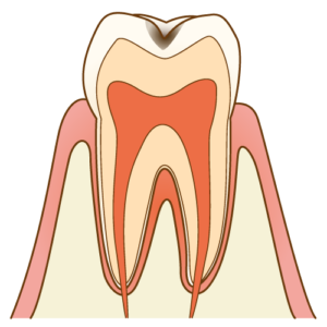 歯髄