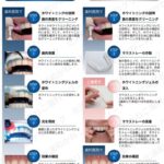 北浦和　ホワイトニング