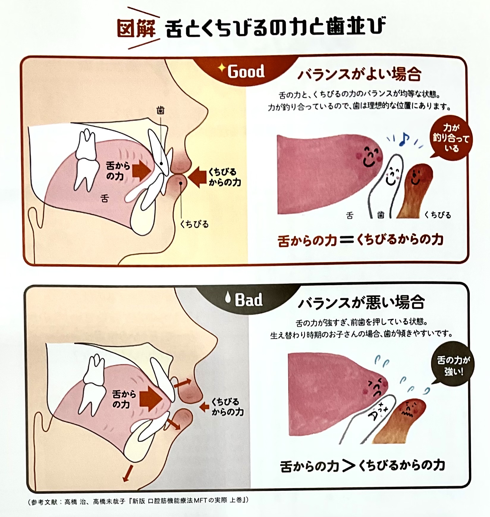 あなたの舌はどこにある?歯並びのためのお口のトレーニング |北浦和の歯医者|北浦和かねこ歯科クリニック