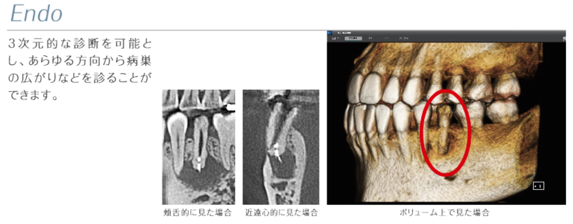 歯科用CT01